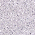 Immunohistochemical staining of human liver shows no positivity in hepatocytes as expected.
