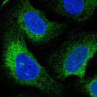 Immunofluorescent staining of human cell line U-2 OS shows localization to endoplasmic reticulum.