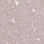 Anti-DPP10 Antibody