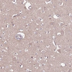 Anti-DPP10 Antibody
