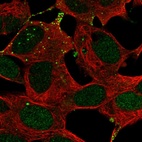 Immunofluorescent staining of human cell line SH-SY5Y shows localization to nucleus & vesicles.