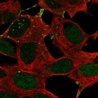 Immunofluorescent staining of human cell line SH-SY5Y shows localization to nucleus & vesicles.