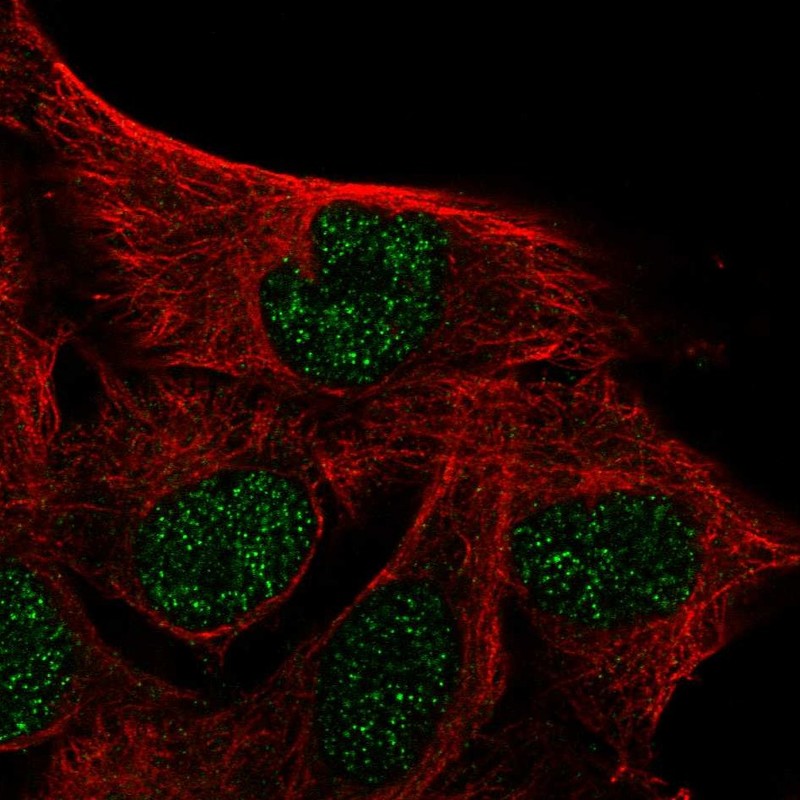 Anti-IQCD Antibody