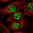 Immunofluorescent staining of human cell line A-431 shows localization to nuclear speckles.