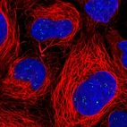 Anti-RAE1 Antibody