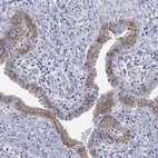 Anti-IFT27 Antibody
