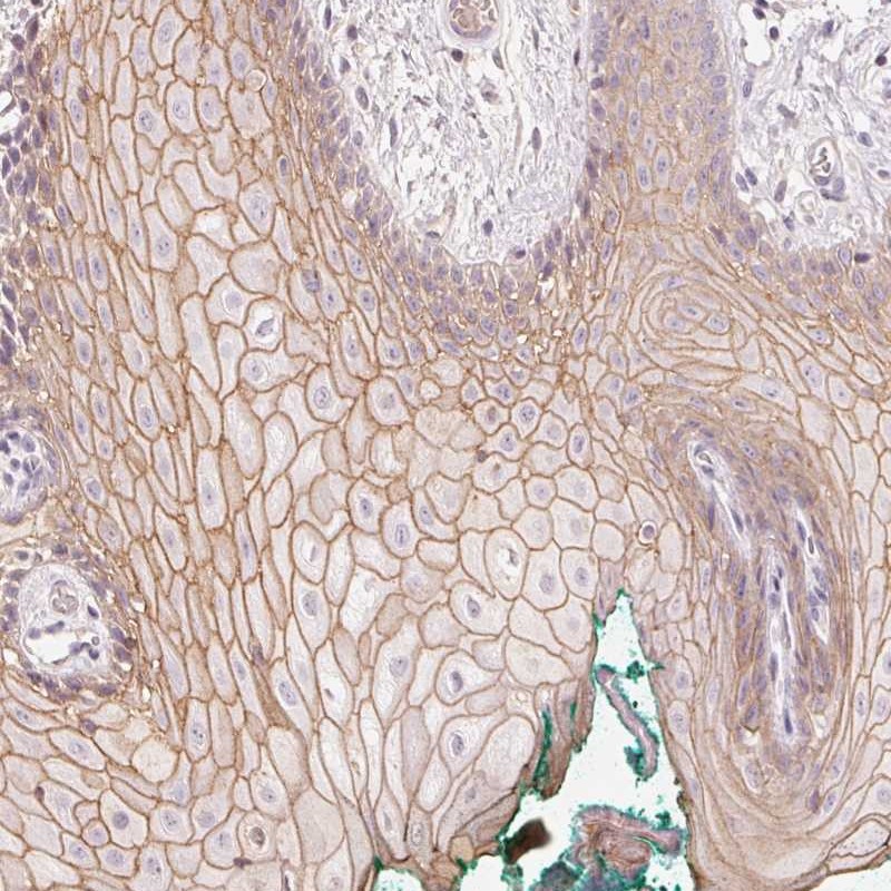 Anti-TP53AIP1 Antibody