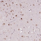 Anti-DDX41 Antibody