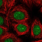 Immunofluorescent staining of human cell line MCF7 shows localization to nucleus & nucleoli.