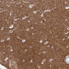 Immunohistochemical staining of human cerebral cortex shows moderate granular cytoplasmic positivity in neurons.