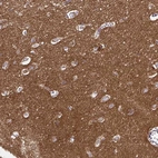 Immunohistochemical staining of human cerebral cortex shows moderate granular cytoplasmic positivity in neurons.