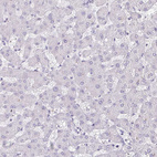 Immunohistochemical staining of human liver shows no positivity in hepatocytes as expected.