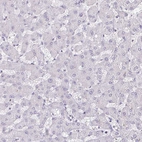 Immunohistochemical staining of human liver shows no positivity in hepatocytes as expected.