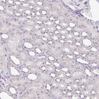 Immunohistochemical staining of human kidney shows no positivity in cells in tubules as expected.
