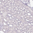 Immunohistochemical staining of human kidney shows no positivity in cells in tubules as expected.