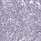 Immunohistochemical staining of human lymph node shows no positivity in non-germinal center cells as expected.