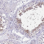 Immunohistochemical staining of human testis shows high expression.