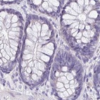 Immunohistochemical staining of human colon using Anti-BOLL antibody HPA048813.