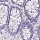 Immunohistochemical staining of human colon using Anti-BOLL antibody HPA048813.