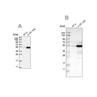 Anti-PDLIM7 Antibody