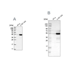 Anti-PDLIM7 Antibody