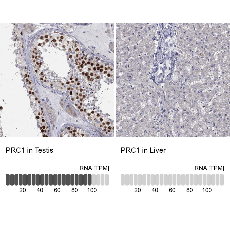 Anti-PRC1 Antibody