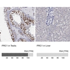 Anti-PRC1 Antibody