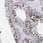 Immunohistochemical staining of human testis shows high expression.