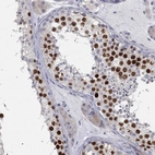 Immunohistochemical staining of human testis shows high expression.