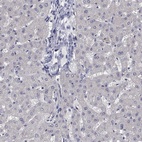 Immunohistochemical staining of human liver shows low expression as expected.