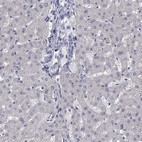 Anti-PRC1 Antibody