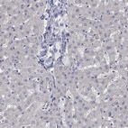 Immunohistochemical staining of human liver shows low expression as expected.