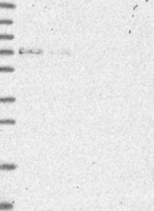 Lane 1: Marker [kDa] 250, 130, 95, 72, 55, 36, 28, 17, 10 | Lane 2: RT4 | Lane 3: U-251 MG | Lane 4: Human Plasma | Lane 5: Liver | Lane 6: Tonsil