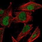 Immunofluorescent staining of human cell line U-251 MG shows localization to nucleoplasm.