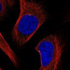 Anti-ODF2 Antibody