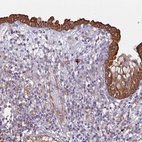 Anti-CEP78 Antibody