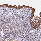 Anti-CEP78 Antibody