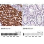 Immunohistochemistry analysis in human liver and colon tissues using HPA048847 antibody. Corresponding EPHX1 RNA-seq data are presented for the same tissues.
