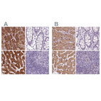 Anti-EPHX1 Antibody