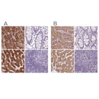 Immunohistochemical staining of human adrenal gland, colon, liver and lymph node using Anti-EPHX1 antibody HPA048847 (A) shows similar protein distribution across tissues to independent antibody HPA020593 (B).