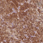 Anti-EPHX1 Antibody