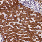 Immunohistochemical staining of human liver shows strong cytoplasmic positivity in hepatocytes.