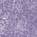 Anti-EPHX1 Antibody