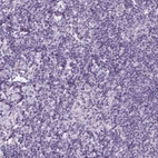Immunohistochemical staining of human tonsil shows low expression as expected.
