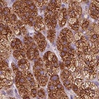 Anti-EPHX1 Antibody