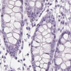 Immunohistochemical staining of human colon using Anti-EPHX1 antibody HPA048847.