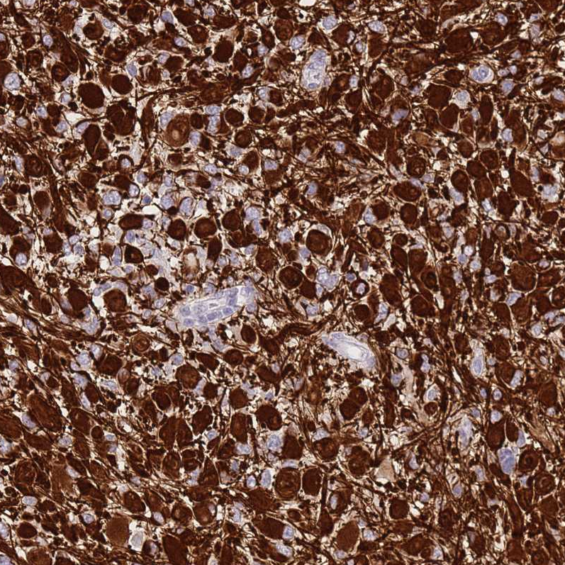 Anti-SHCBP1 Antibody