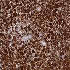 Anti-SHCBP1 Antibody