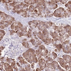 Anti-DET1 Antibody