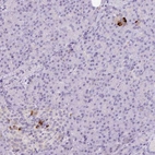 Anti-KCNJ11 Antibody